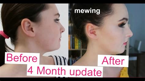 does mewing really do anything